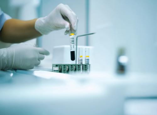 Fittség az újévben - Szűrővizsgálatok a sikeres edzéstervhez